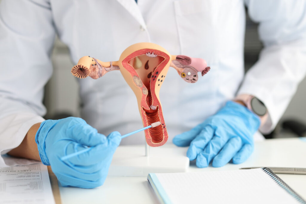 PAP Smear